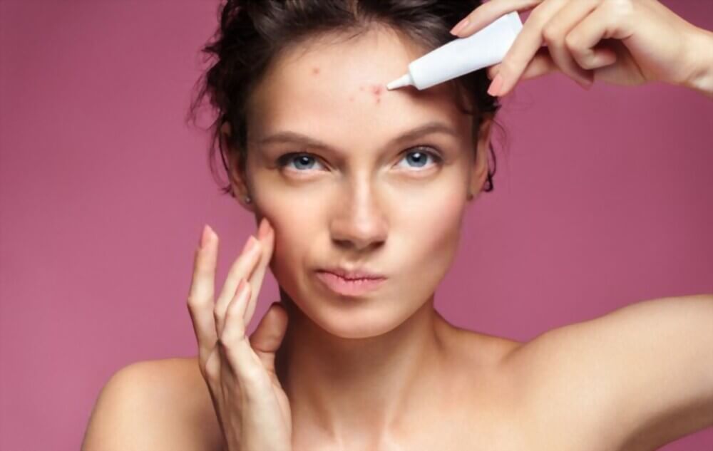 What Is The Best Acne Treatment Vogue Fashion Blog 9567